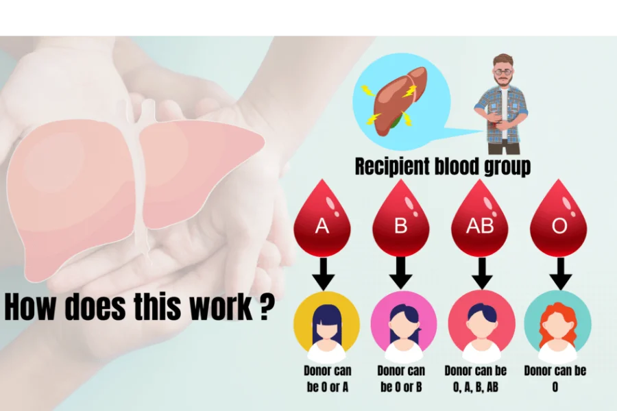 ABO Incompatible Liver Transplant
